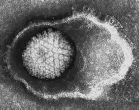 cytomegalovirus.jpg